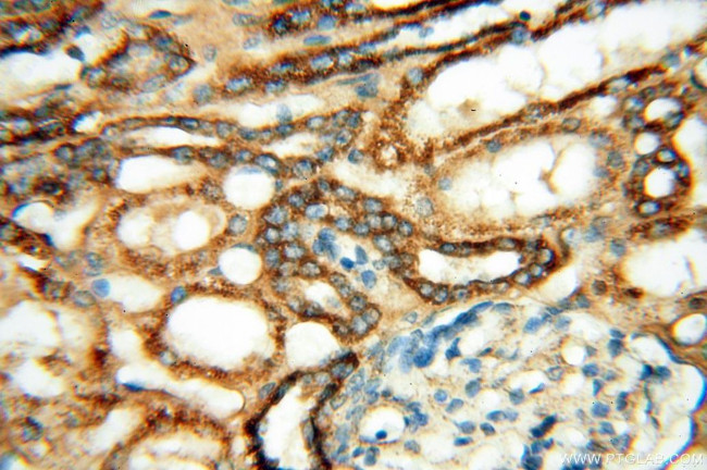 MYO1A Antibody in Immunohistochemistry (Paraffin) (IHC (P))