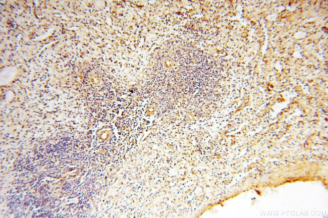 MYO1A Antibody in Immunohistochemistry (Paraffin) (IHC (P))