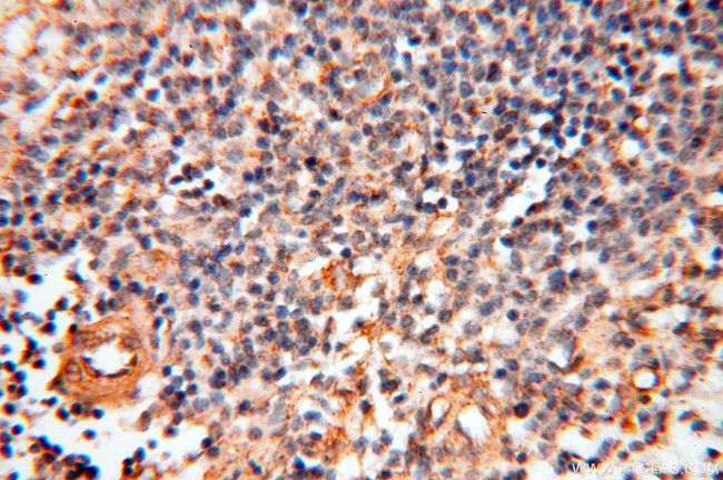 MYO1A Antibody in Immunohistochemistry (Paraffin) (IHC (P))