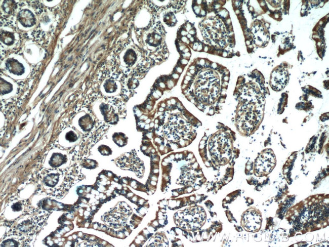 MYO1A Antibody in Immunohistochemistry (Paraffin) (IHC (P))