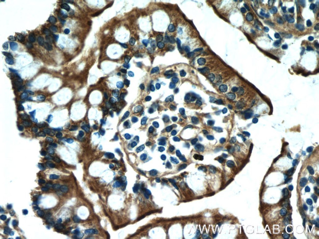 MYO1A Antibody in Immunohistochemistry (Paraffin) (IHC (P))