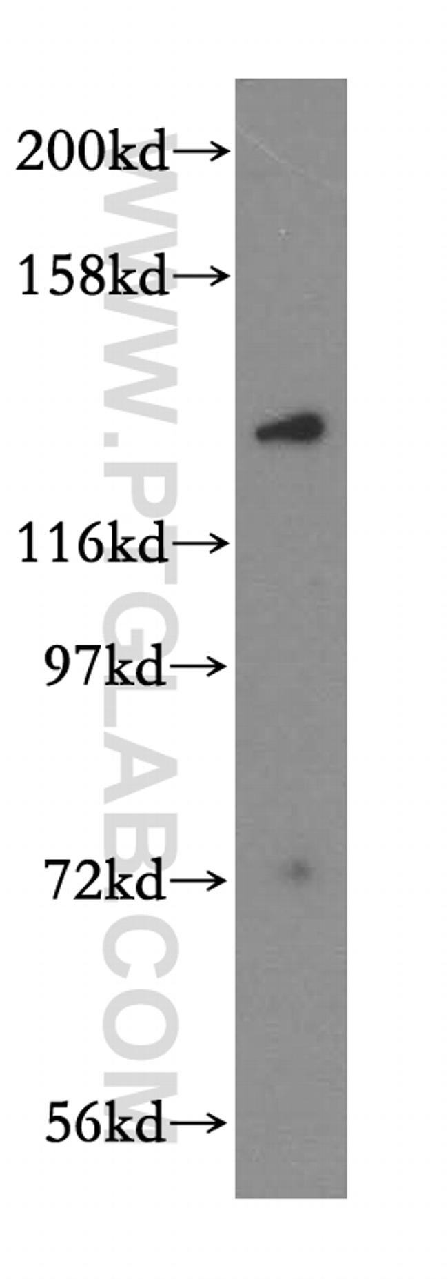 MYO1A Antibody in Western Blot (WB)