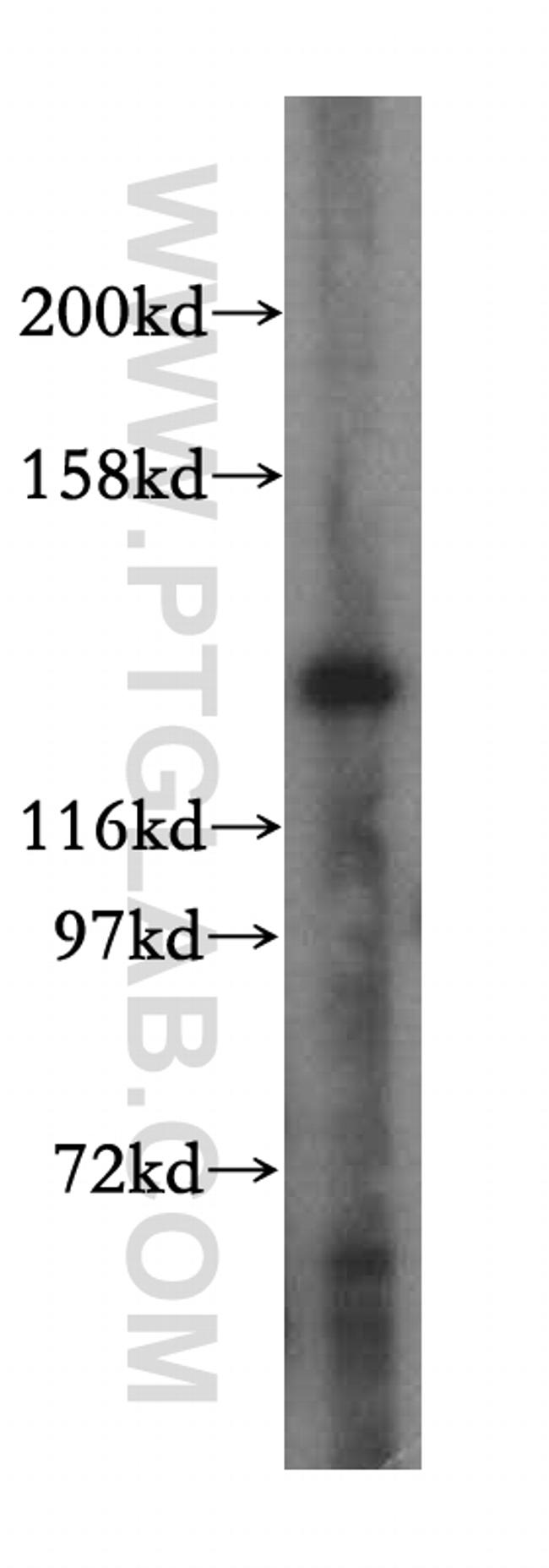MYO1A Antibody in Western Blot (WB)