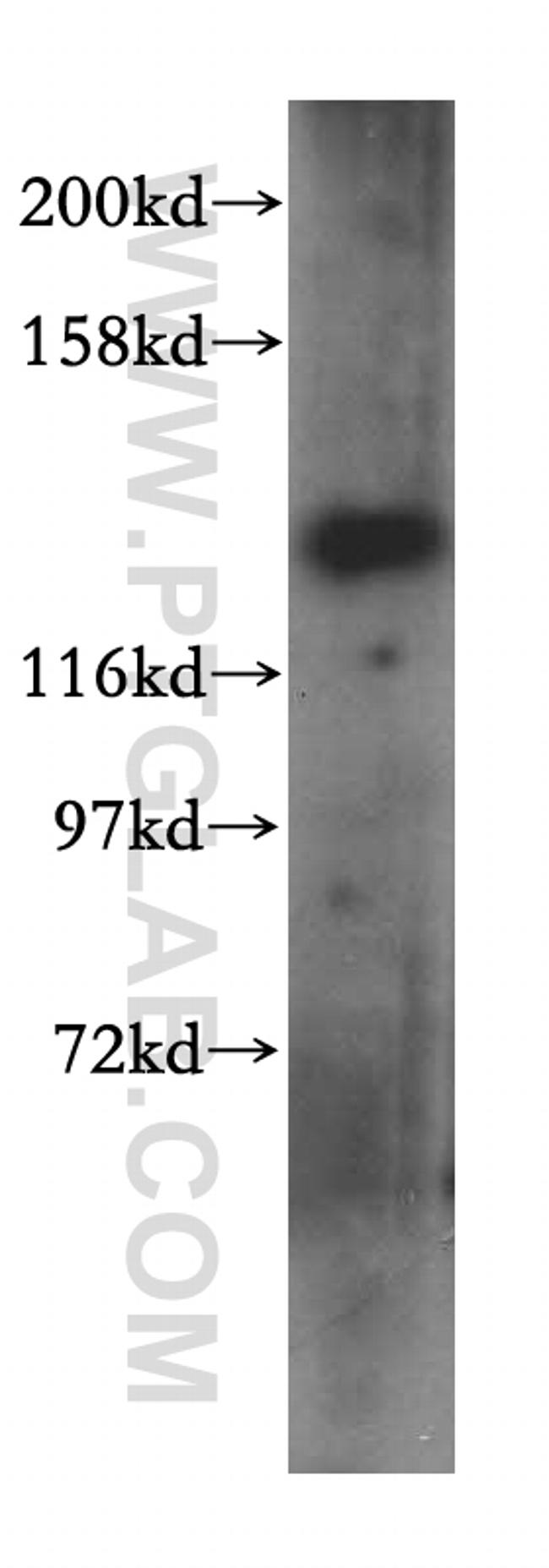 MYO1A Antibody in Western Blot (WB)