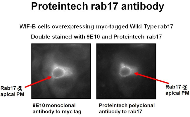 RAB17 Antibody in Immunocytochemistry (ICC/IF)