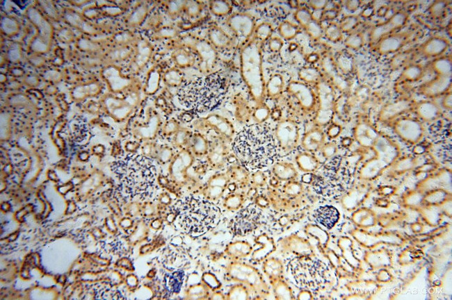 EIF4A3 Antibody in Immunohistochemistry (Paraffin) (IHC (P))