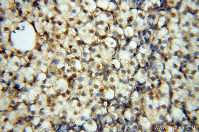 EIF4A3 Antibody in Immunohistochemistry (Paraffin) (IHC (P))