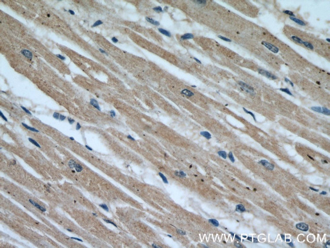 EIF4A3 Antibody in Immunohistochemistry (Paraffin) (IHC (P))