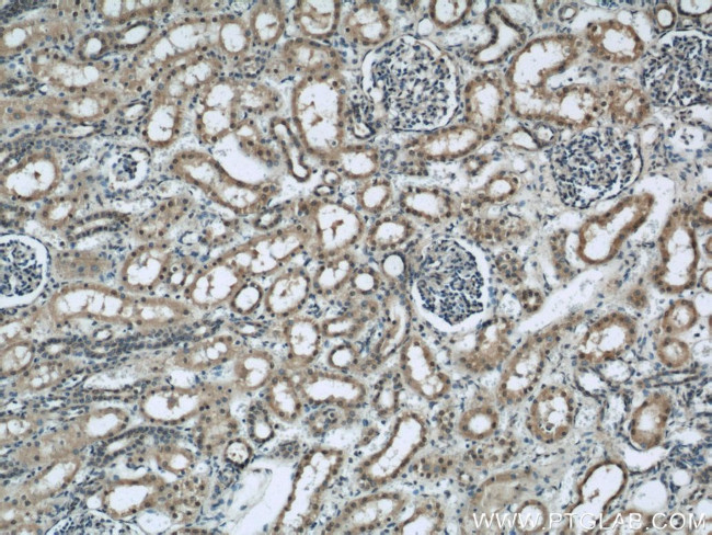 EIF4A3 Antibody in Immunohistochemistry (Paraffin) (IHC (P))