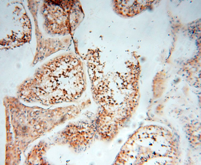 EIF4A3 Antibody in Immunohistochemistry (Paraffin) (IHC (P))