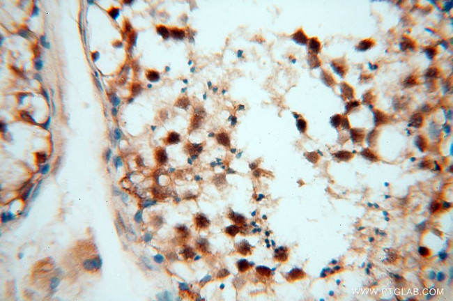 EIF4A3 Antibody in Immunohistochemistry (Paraffin) (IHC (P))