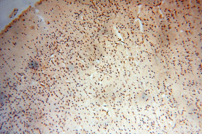 EIF4A3 Antibody in Immunohistochemistry (Paraffin) (IHC (P))