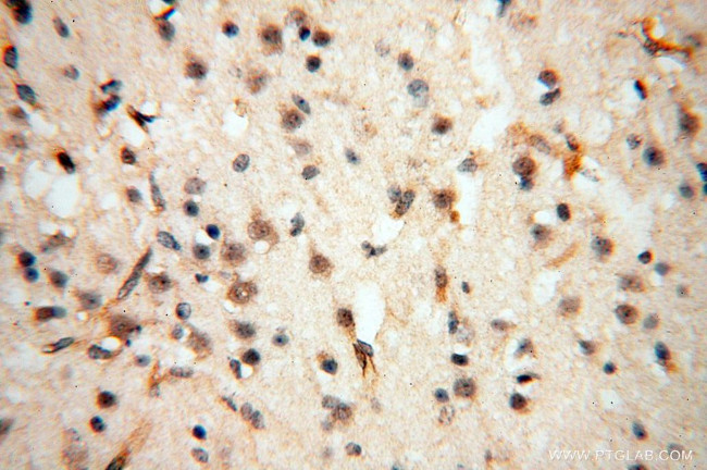 EIF4A3 Antibody in Immunohistochemistry (Paraffin) (IHC (P))