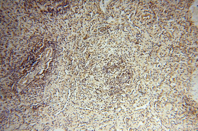 EIF4A3 Antibody in Immunohistochemistry (Paraffin) (IHC (P))