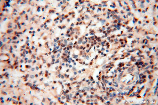 EIF4A3 Antibody in Immunohistochemistry (Paraffin) (IHC (P))