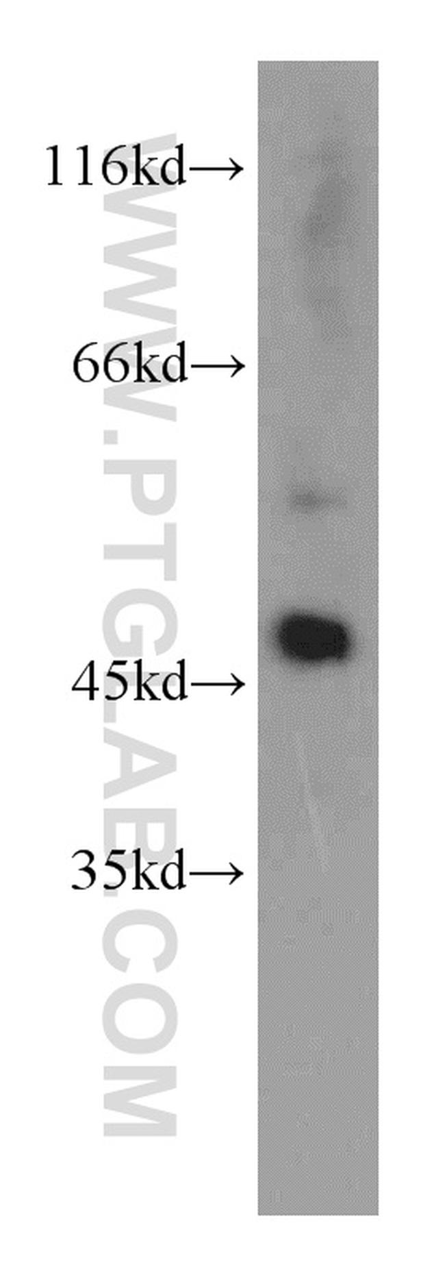 EIF4A3 Antibody in Western Blot (WB)