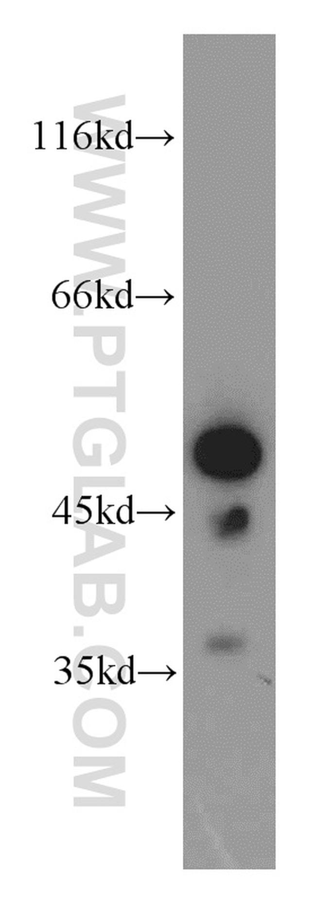 EIF4A3 Antibody in Western Blot (WB)