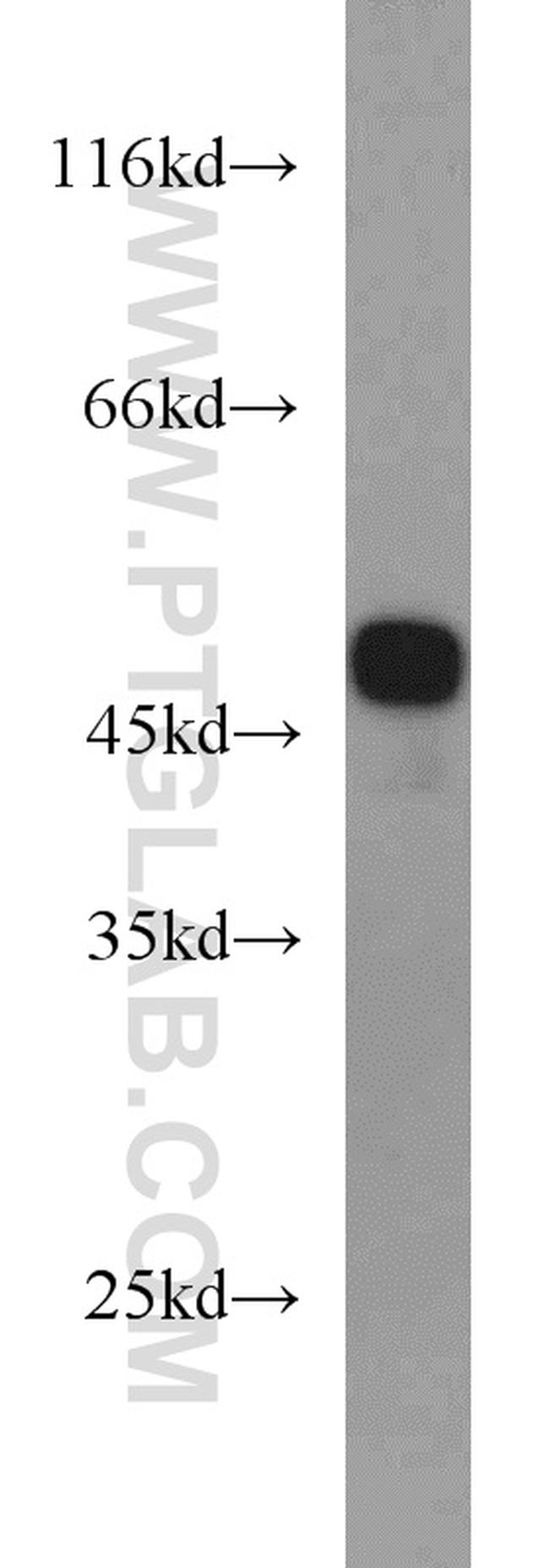 EIF4A3 Antibody in Western Blot (WB)