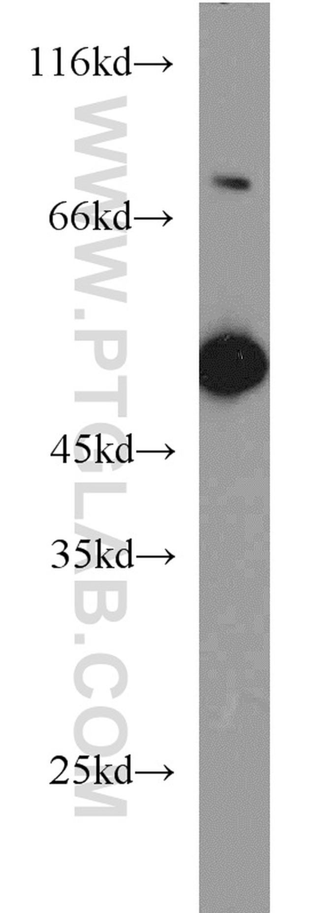 EIF4A3 Antibody in Western Blot (WB)