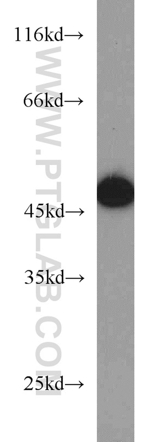 EIF4A3 Antibody in Western Blot (WB)