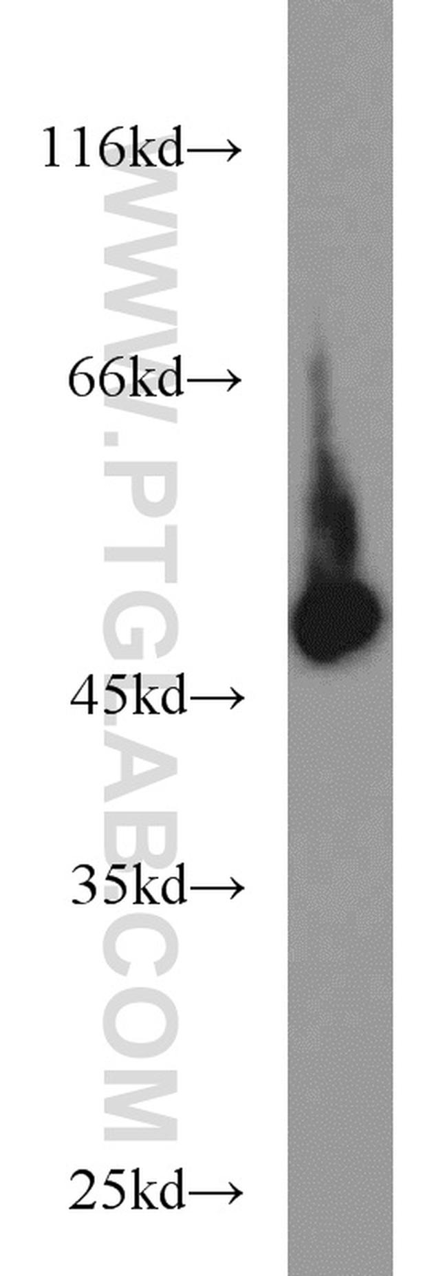 EIF4A3 Antibody in Western Blot (WB)