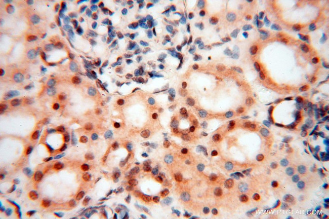 EIF4A3 Antibody in Immunohistochemistry (Paraffin) (IHC (P))