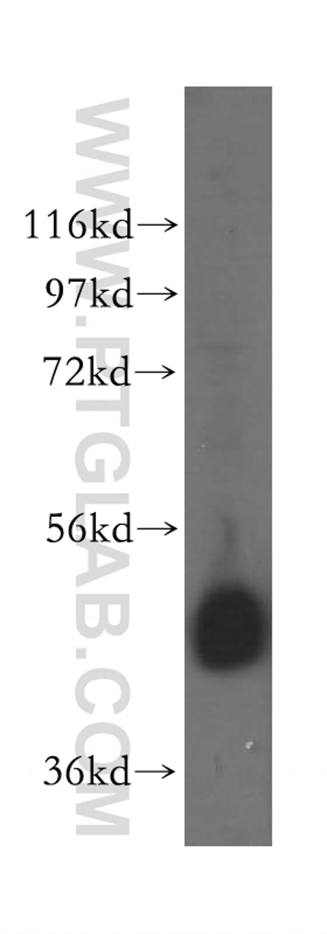 EIF4A3 Antibody in Western Blot (WB)