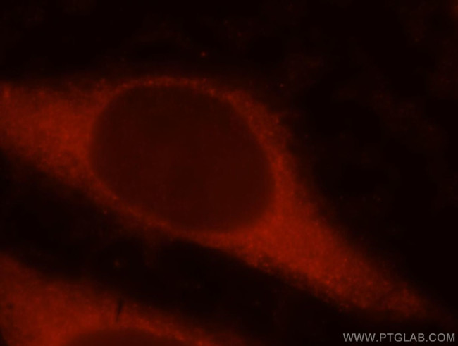 RAI14 Antibody in Immunocytochemistry (ICC/IF)