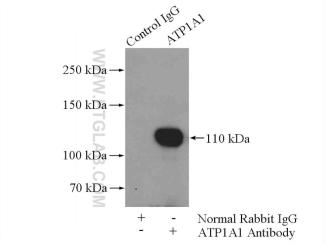 RAI14 Antibody in Immunoprecipitation (IP)