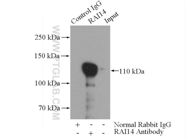 RAI14 Antibody in Immunoprecipitation (IP)