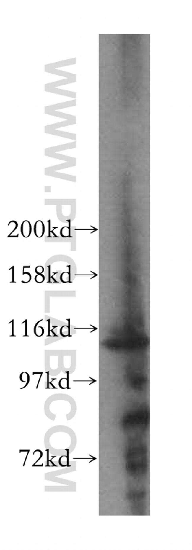 RAI14 Antibody in Western Blot (WB)