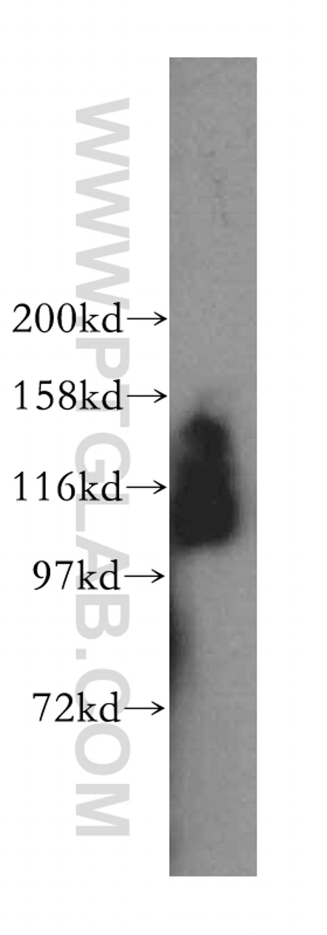 RAI14 Antibody in Western Blot (WB)