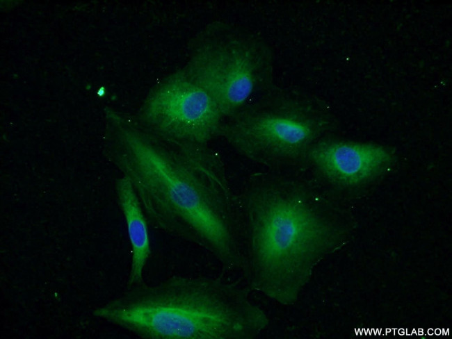 IRS1 Antibody in Immunocytochemistry (ICC/IF)