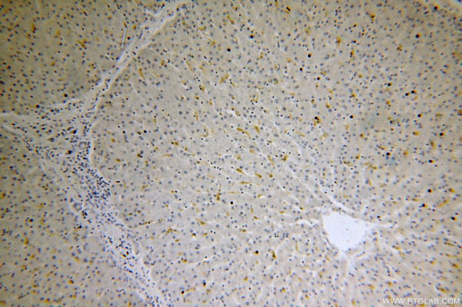 IRS1 Antibody in Immunohistochemistry (Paraffin) (IHC (P))