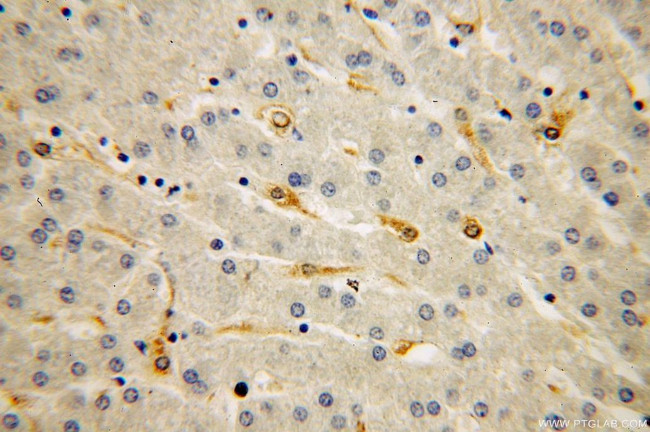 IRS1 Antibody in Immunohistochemistry (Paraffin) (IHC (P))