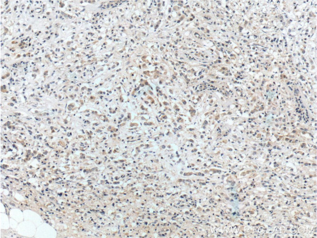 IRS1 Antibody in Immunohistochemistry (Paraffin) (IHC (P))