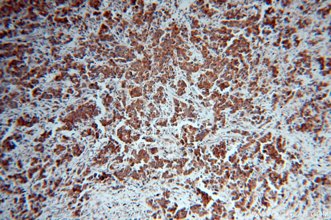 IRS1 Antibody in Immunohistochemistry (Paraffin) (IHC (P))