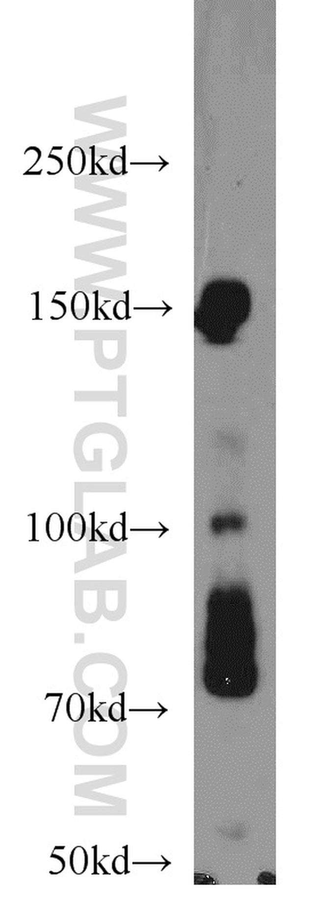 IRS1 Antibody in Western Blot (WB)