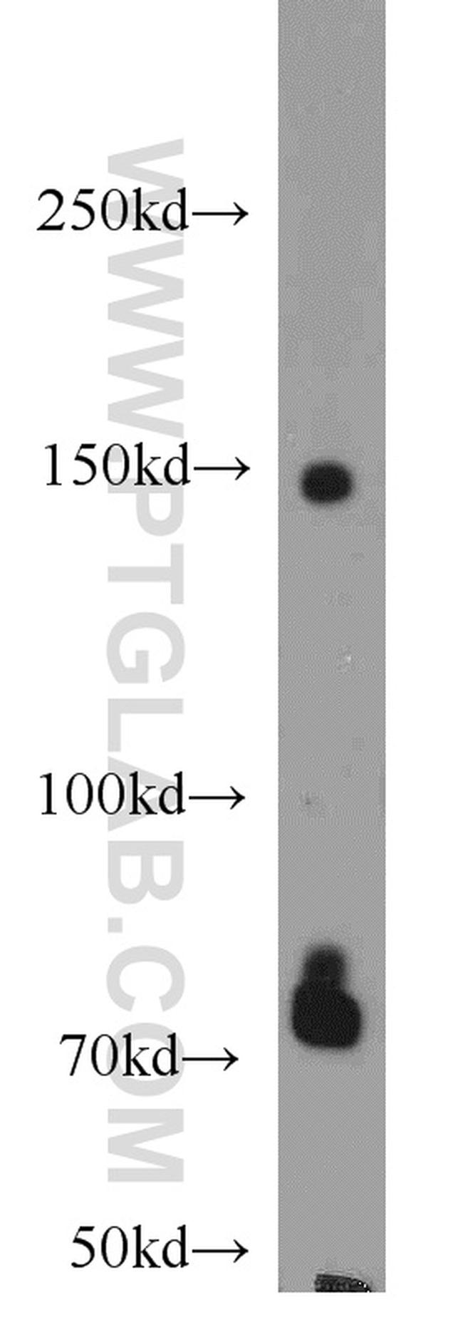 IRS1 Antibody in Western Blot (WB)