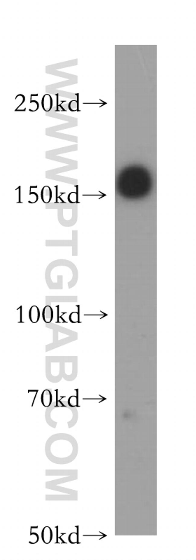 IRS1 Antibody in Western Blot (WB)