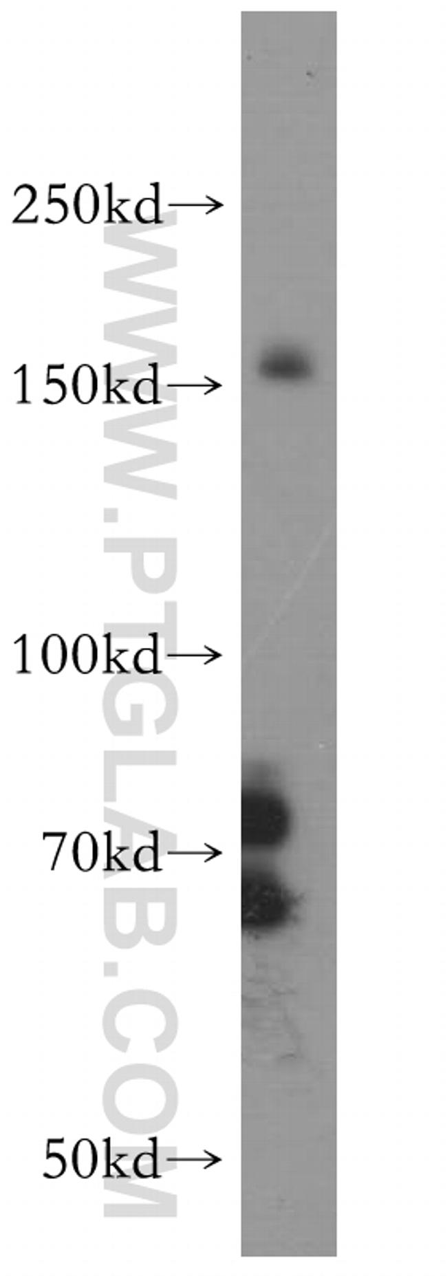 IRS1 Antibody in Western Blot (WB)