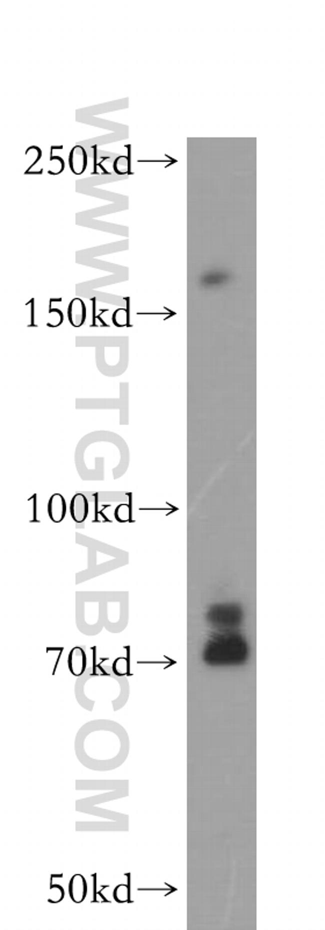 IRS1 Antibody in Western Blot (WB)