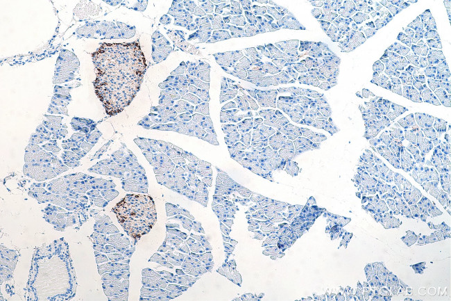 Somatostatin Antibody in Immunohistochemistry (Paraffin) (IHC (P))