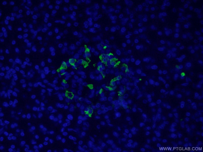 Somatostatin Antibody in Immunohistochemistry (PFA fixed) (IHC (PFA))