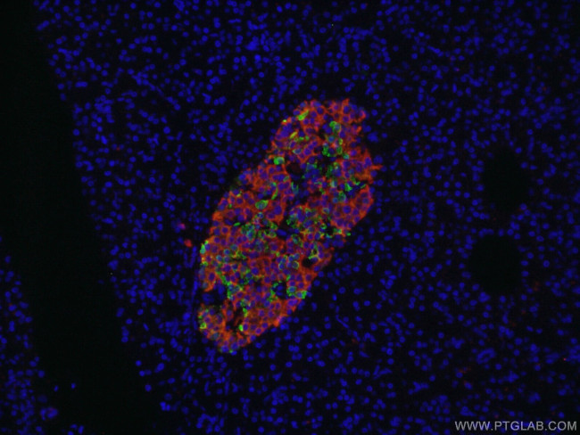 Somatostatin Antibody in Immunohistochemistry (PFA fixed) (IHC (PFA))