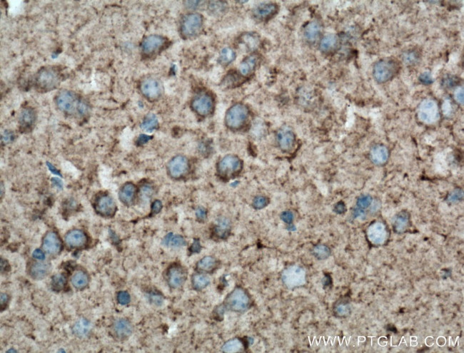 Somatostatin Antibody in Immunohistochemistry (Paraffin) (IHC (P))