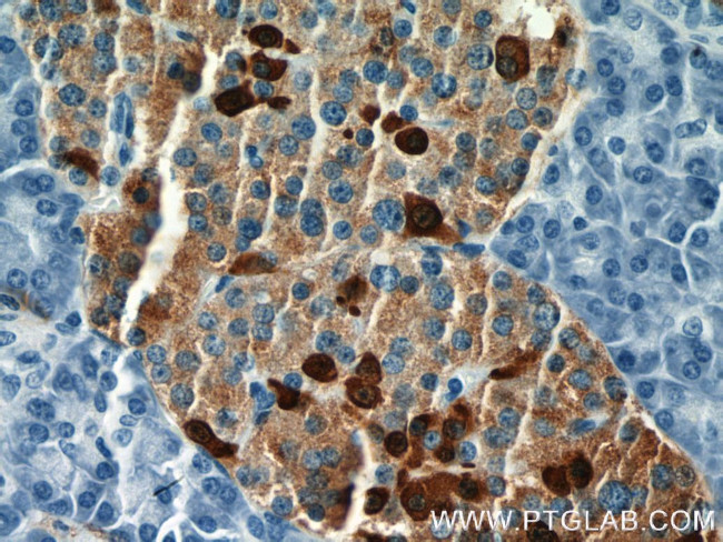 Somatostatin Antibody in Immunohistochemistry (Paraffin) (IHC (P))