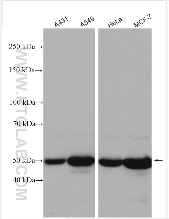 Cytokeratin 8 Antibody in Western Blot (WB)