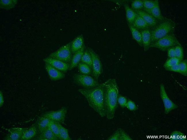 Cytokeratin 8 Antibody in Immunocytochemistry (ICC/IF)