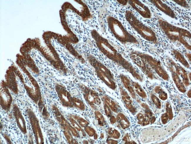 Cytokeratin 8 Antibody in Immunohistochemistry (Paraffin) (IHC (P))